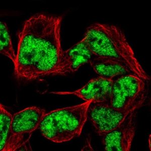 Anti-SNRPB antibody produced in rabbit 