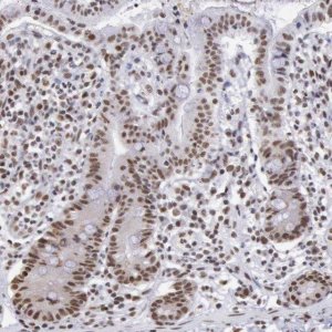 Anti-SNRPD3 antibody produced in rabbit 