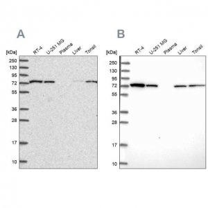 Anti-SNX1 antibody produced in rabbit 