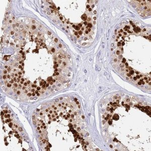 Anti-SNX20 antibody produced in rabbit 