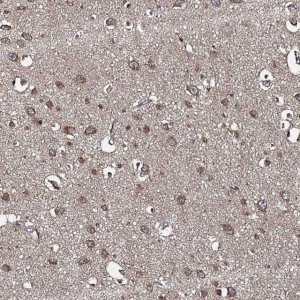 Anti-SNX32 antibody produced in rabbit 