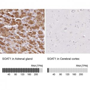Anti-SOAT1 antibody produced in rabbit 