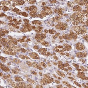 Anti-SOAT1 antibody produced in rabbit 