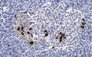 Anti-Somatostatin-28 Antibody, clone 2B19 ZooMAb Rabbit Monoclonal 