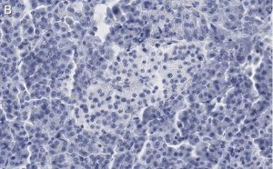 Anti-Somatostatin-28 Antibody, clone 2B19 ZooMAb Rabbit Monoclonal 