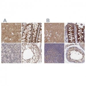 Anti-SORBS1 antibody produced in rabbit 