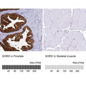 Anti-SORD antibody produced in rabbit HPA040260-100UL
