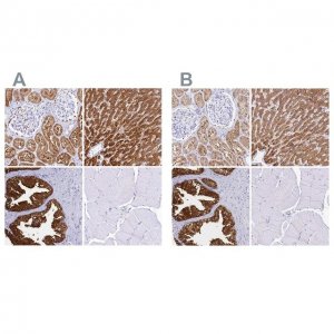 Anti-SORD antibody produced in rabbit HPA040260-100UL