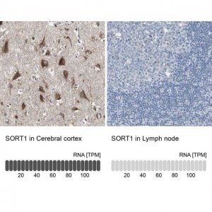 Anti-SORT1 antibody produced in rabbit 
