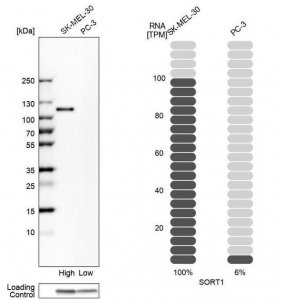 Anti-SORT1 antibody produced in rabbit 