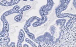 Anti-SOX17 Antibody, clone 3F7, ZooMAb Rabbit Monoclonal 