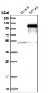 Anti-SOX30 antibody produced in rabbit 
