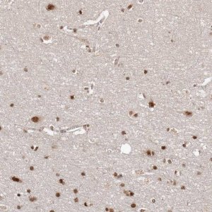 Anti-SOX4 antibody produced in rabbit 