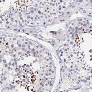 Anti-SOX6 antibody produced in rabbit 