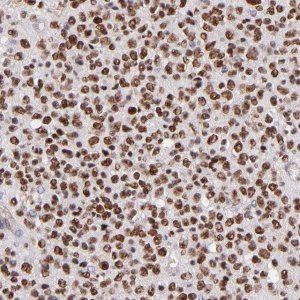 Anti-SOX6 antibody produced in rabbit 