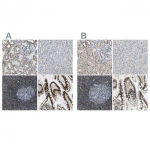 Anti-SP100 antibody produced in rabbit 