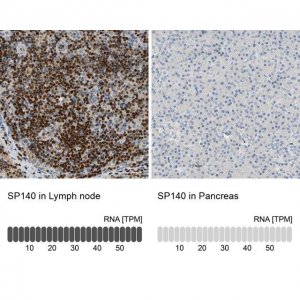 Anti-SP140 antibody produced in rabbit 
