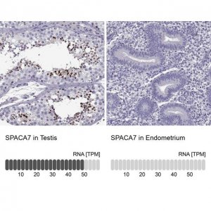 Anti-SPACA7 