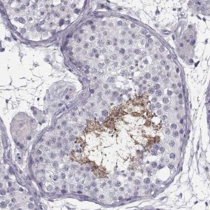 Anti-SPACA9 antibody produced in rabbit 
