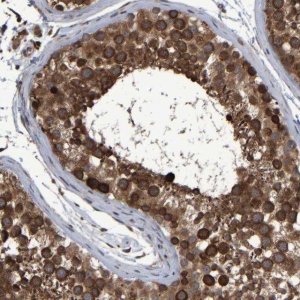 Anti-SPAG5 antibody produced in rabbit 