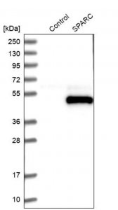 Anti-SPARC antibody produced in rabbit 