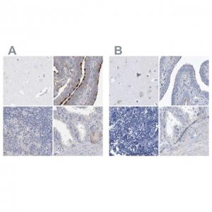 Anti-SPATA18 antibody produced in rabbit 