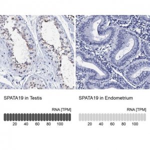 Anti-SPATA19 antibody produced in rabbit 