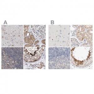 Anti-SPATA20 antibody produced in rabbit 