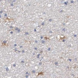 Anti-SPATA20 antibody produced in rabbit 