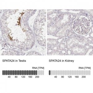 Anti-SPATA24 antibody produced in rabbit 