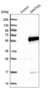 Anti-SPATA2L antibody produced in rabbit 