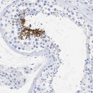 Anti-SPATA3 antibody produced in rabbit 