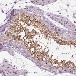 Anti-SPATA31E1 antibody produced in rabbit 