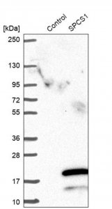 Anti-SPCS1 antibody produced in rabbit HPA046091-100UL