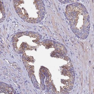 Anti-SPCS1 antibody produced in rabbit HPA046091-100UL