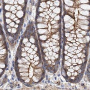 Anti-SPECC1 antibody produced in rabbit 