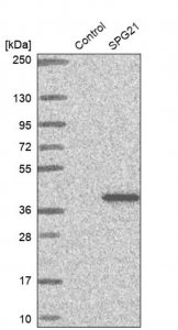 Anti-SPG21 antibody produced in rabbit 