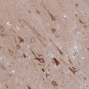Anti-SPHKAP antibody produced in rabbit 