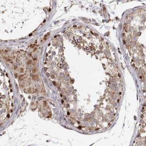 Anti-SPICE1 antibody produced in rabbit 