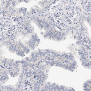 Anti-SPINK2 antibody produced in rabbit 