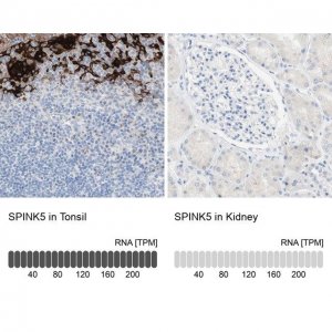 Anti-SPINK5 antibody produced in rabbit 