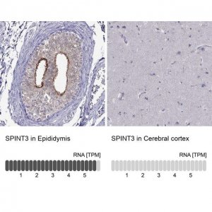 Anti-SPINT3 