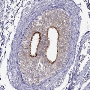 Anti-SPINT3 