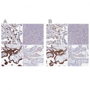 Anti-SPNS1 antibody produced in rabbit 
