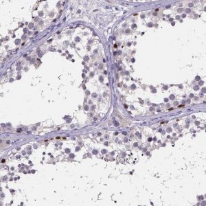 Anti-SPOCD1 antibody produced in rabbit 