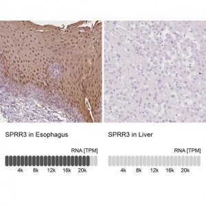 Anti-SPRR3 antibody produced in rabbit 