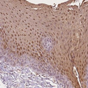 Anti-SPRR3 antibody produced in rabbit 