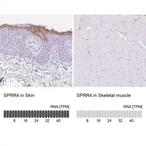 Anti-SPRR4 antibody produced in rabbit 