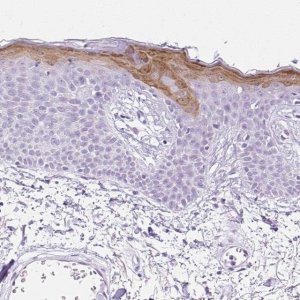 Anti-SPRR4 antibody produced in rabbit 