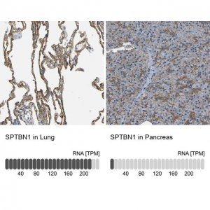 Anti-SPTBN1 antibody produced in rabbit 